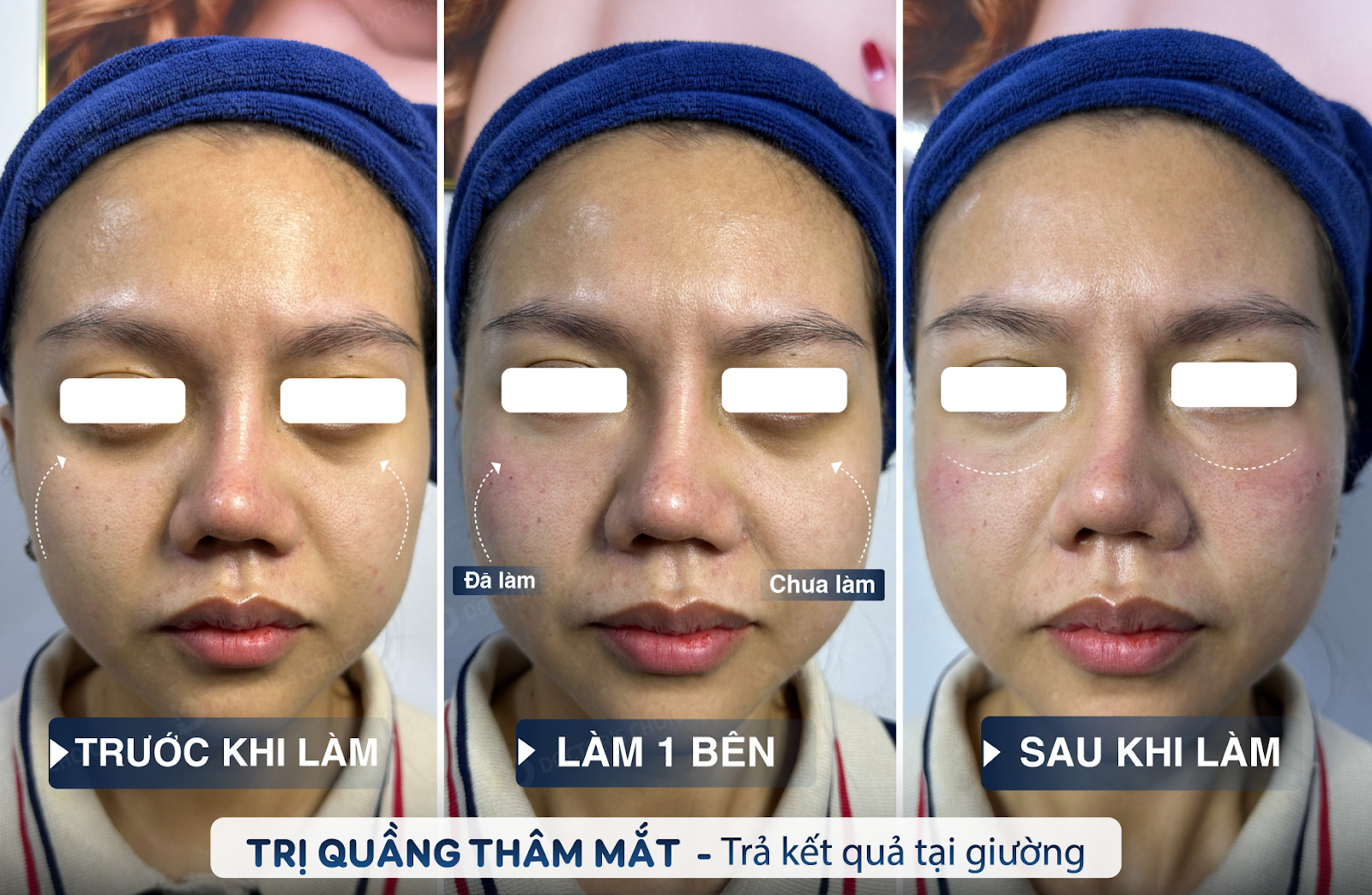 Khám phá bí quyết chăm sóc da an toàn với Dr Choice Clinic 13