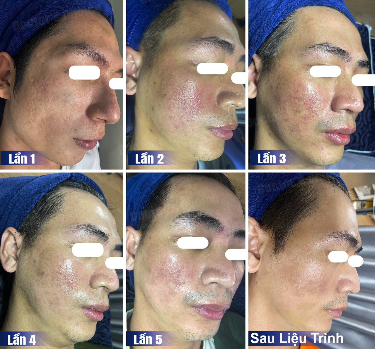 Khám phá bí quyết chăm sóc da an toàn với Dr Choice Clinic 12