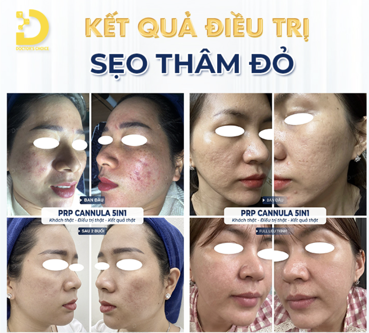 Khám phá bí quyết chăm sóc da an toàn với Dr Choice Clinic 14